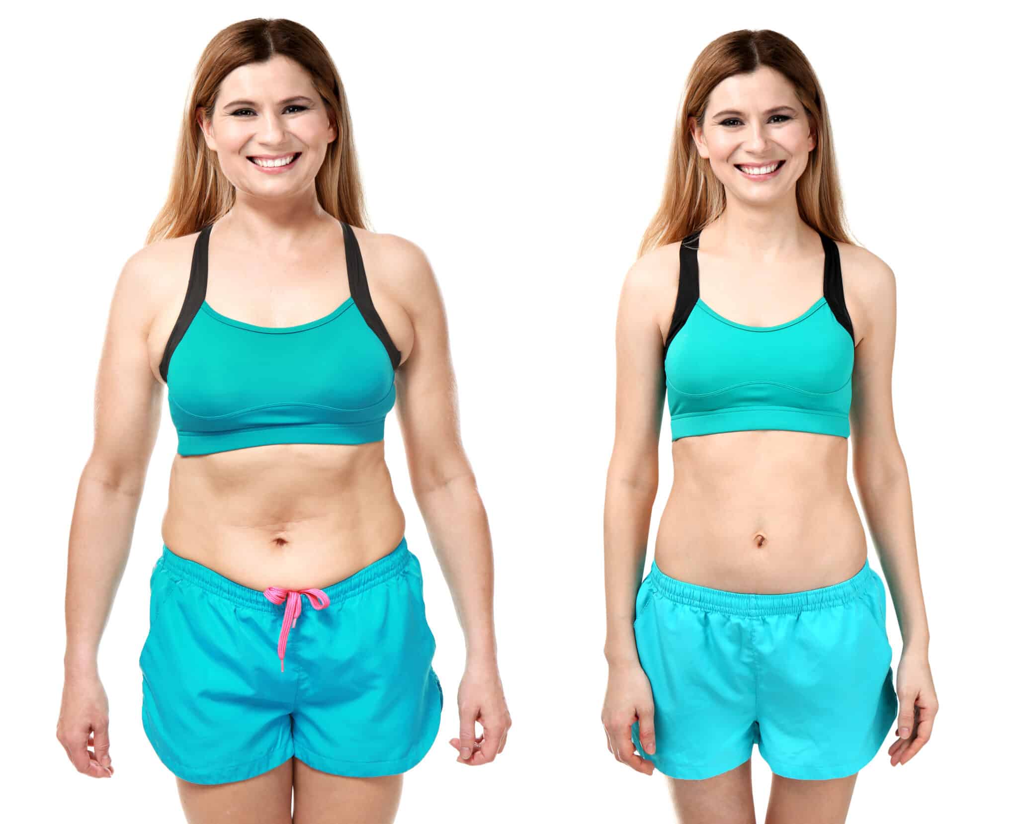 antes e depois de emagrecer da Perda de peso com saúde